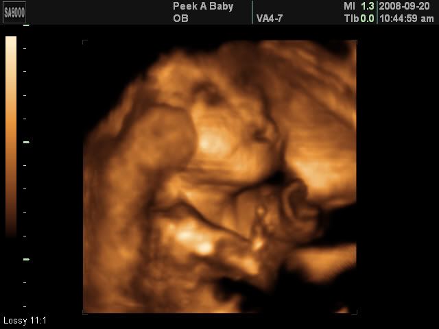 3d ultrasound pictures at 26 weeks. Anyone get a 3D ultrasound