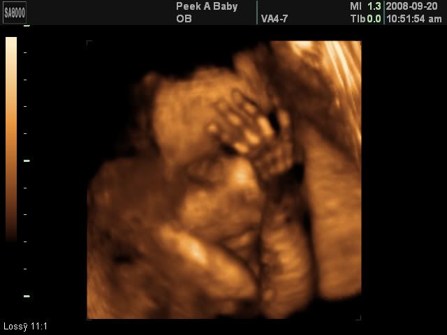 3d ultrasound pictures at 26 weeks. Anyone get a 3D ultrasound from 24-26 weeks?